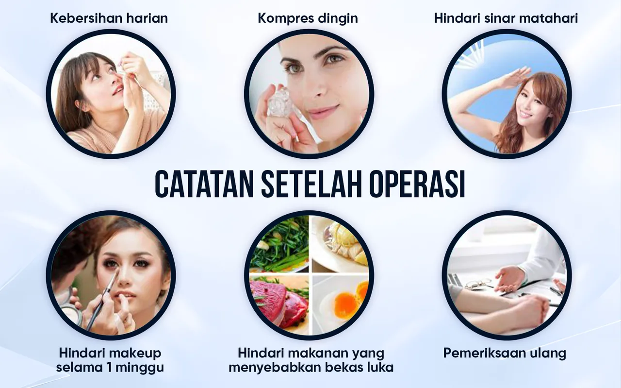 Ilustrasi Pengangkatan Alis – Rahasia Wajah Awet Muda bagian 2