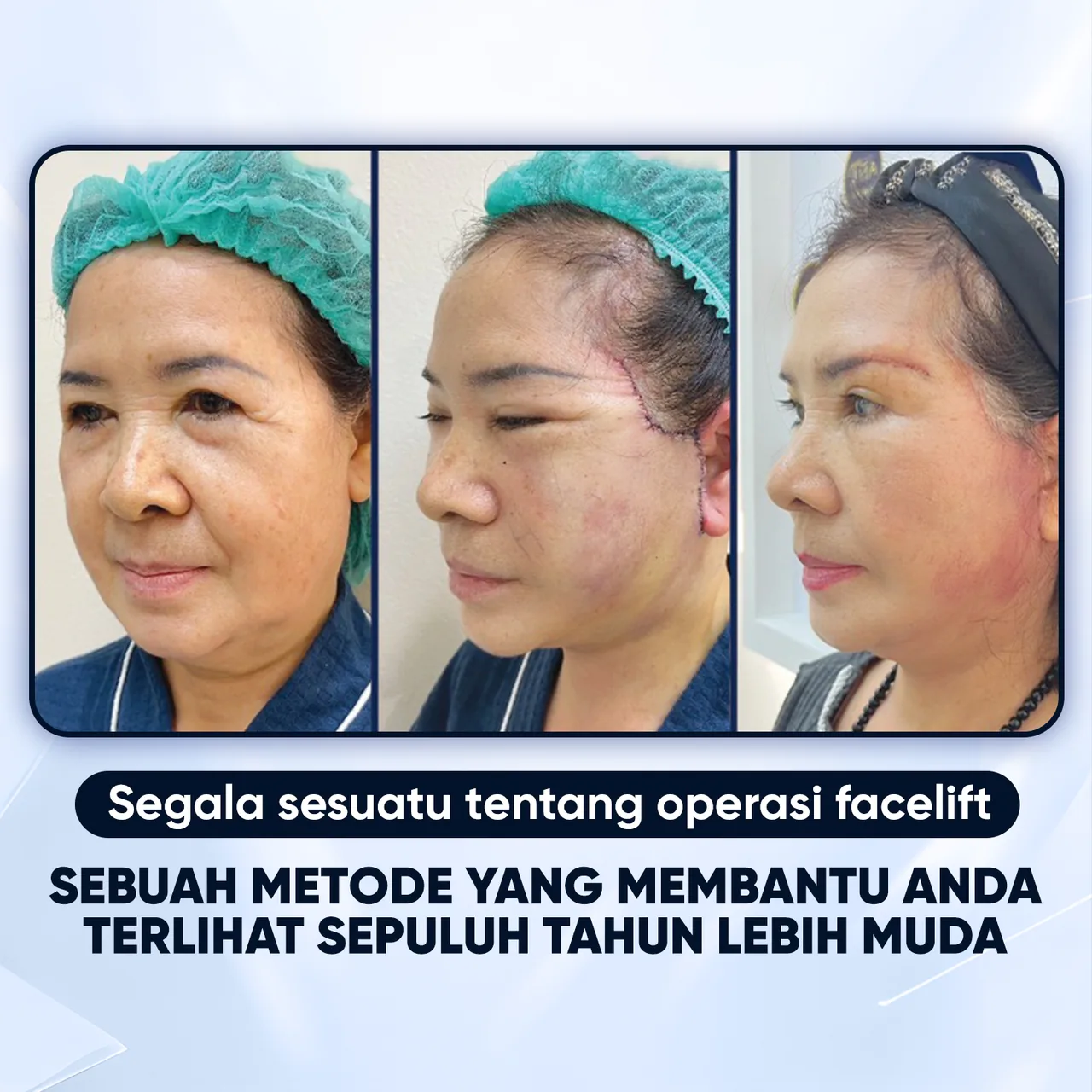 Ilustrasi Facelift 9D – Kunci Kulit Awet Muda bagian 6