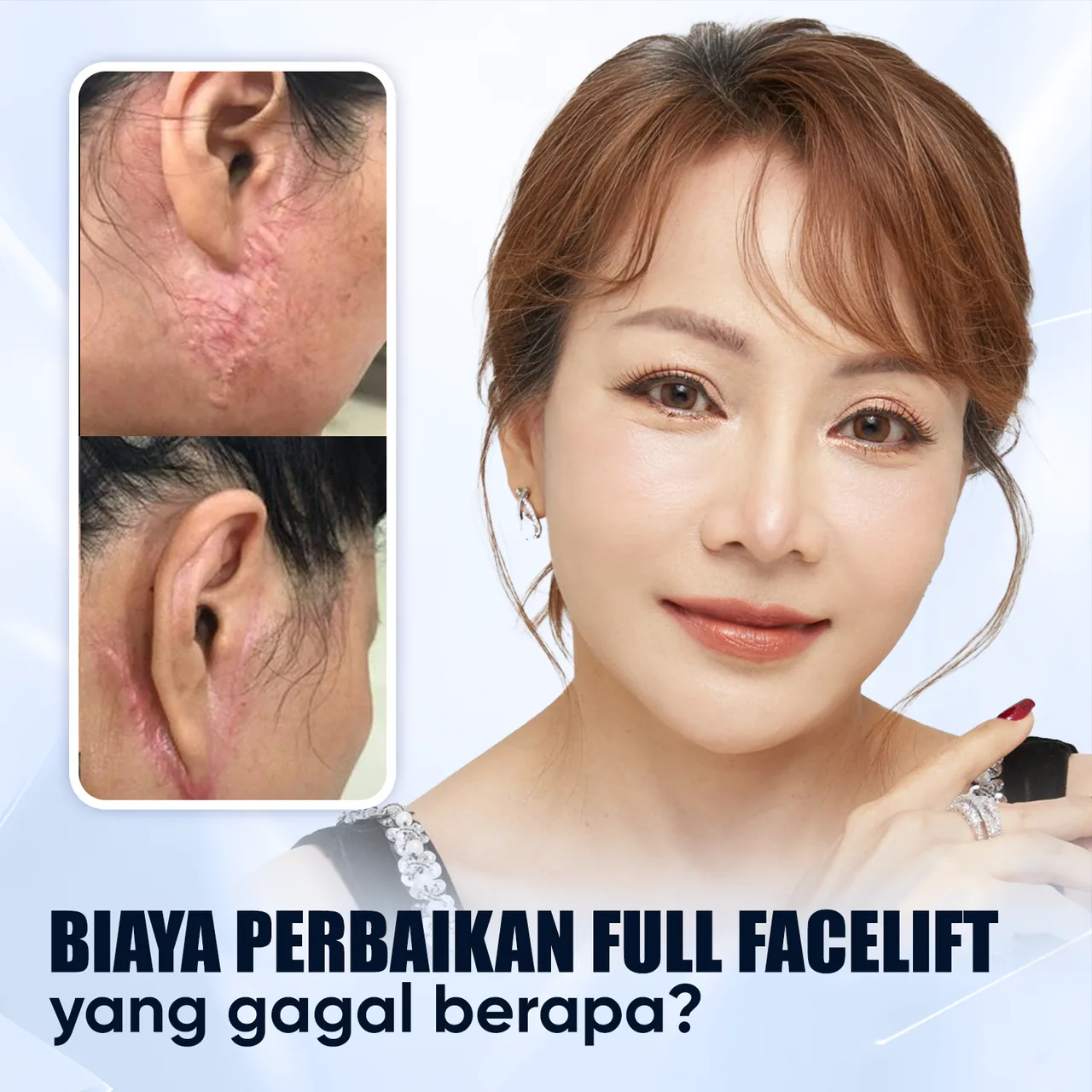 Ilustrasi Facelift 9D – Kunci Kulit Awet Muda bagian 7
