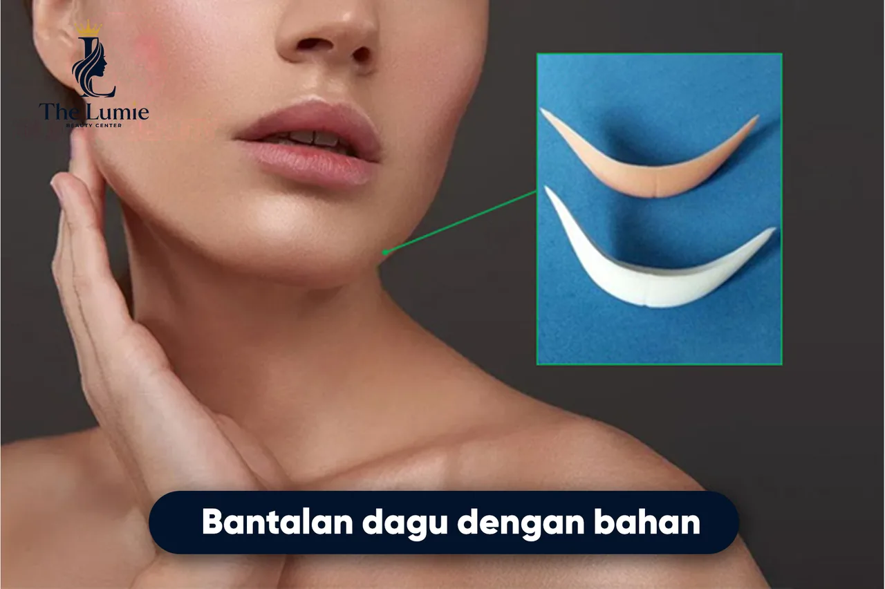 Ilustrasi Implan Dagu – Rahasia Wajah V-Line yang Anggun bagian 1