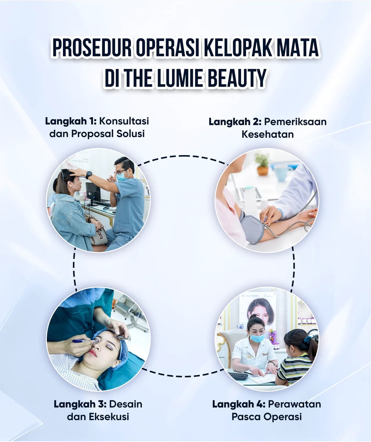 Ilustrasi Tata Bentuk Kelopak Mata Ganda – Transformasi Mata Indah & Alami bagian 6