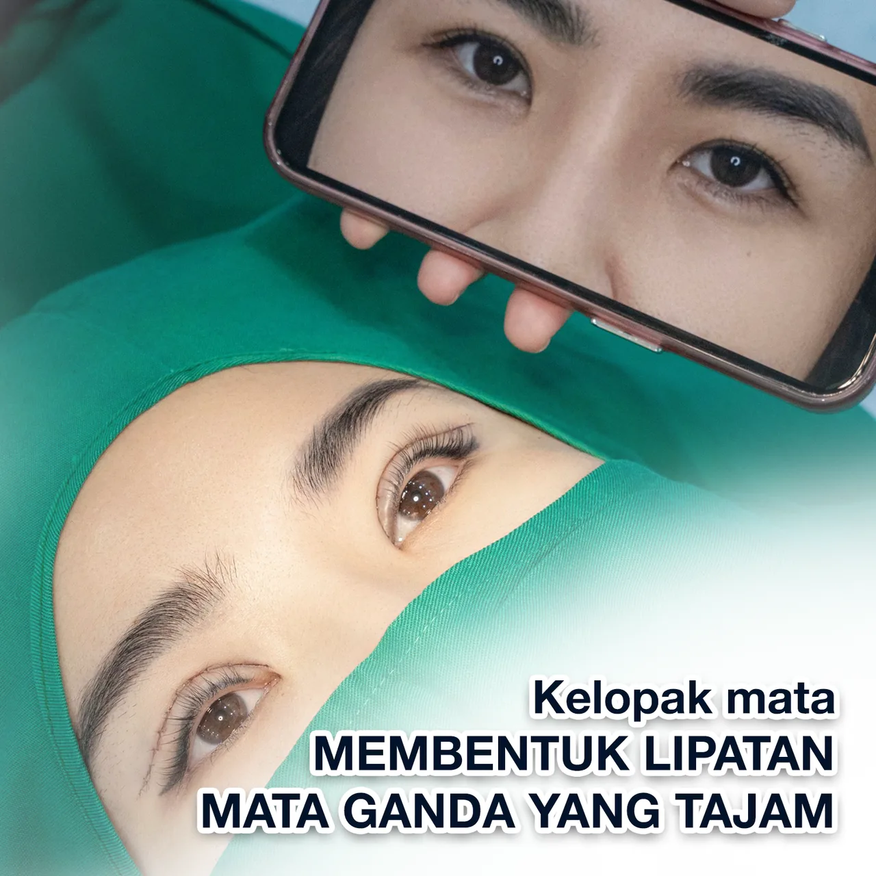 Ilustrasi Tata Bentuk Kelopak Mata Ganda – Transformasi Mata Indah & Alami bagian 7