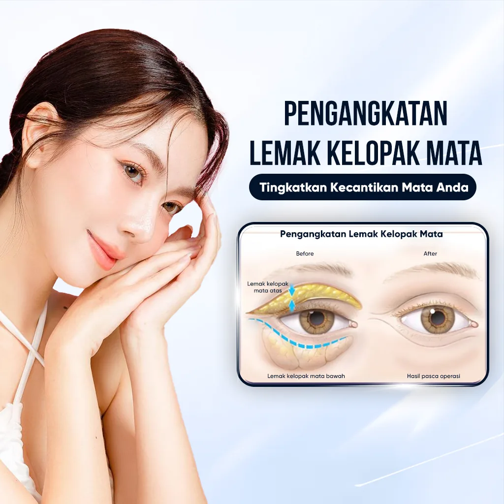 Ilustrasi Tata Bentuk Kelopak Mata Ganda – Transformasi Mata Indah & Alami bagian 8