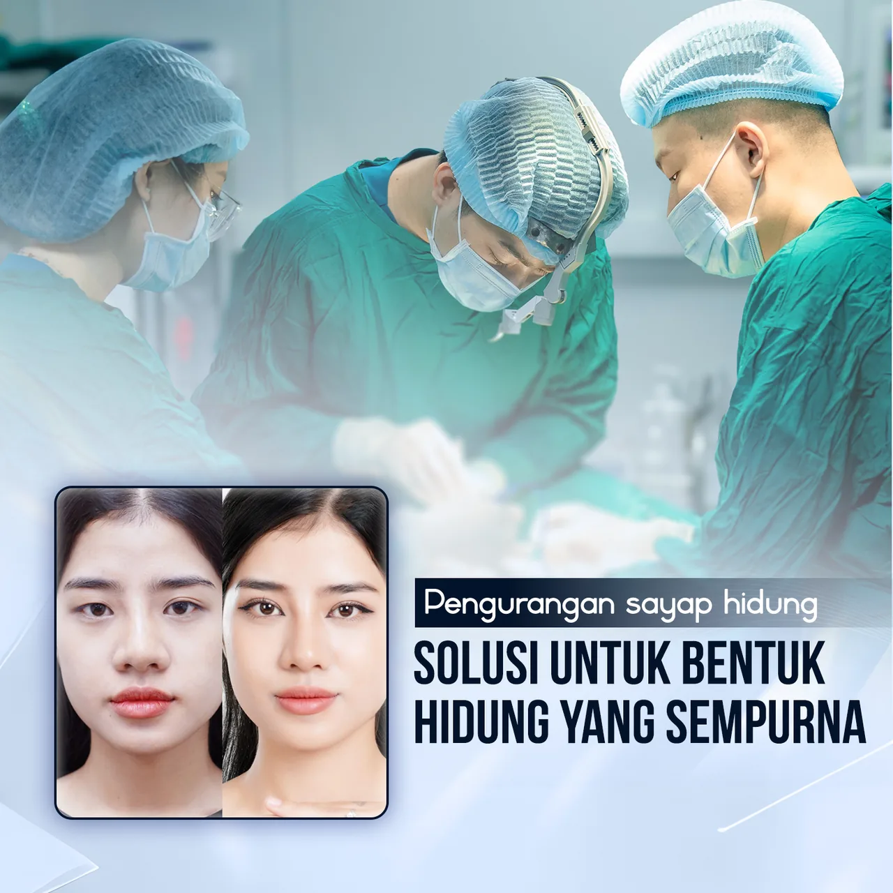 Ilustrasi Pembentukan Hidung Estetika – Panduan Rhinoplasty bagian 4