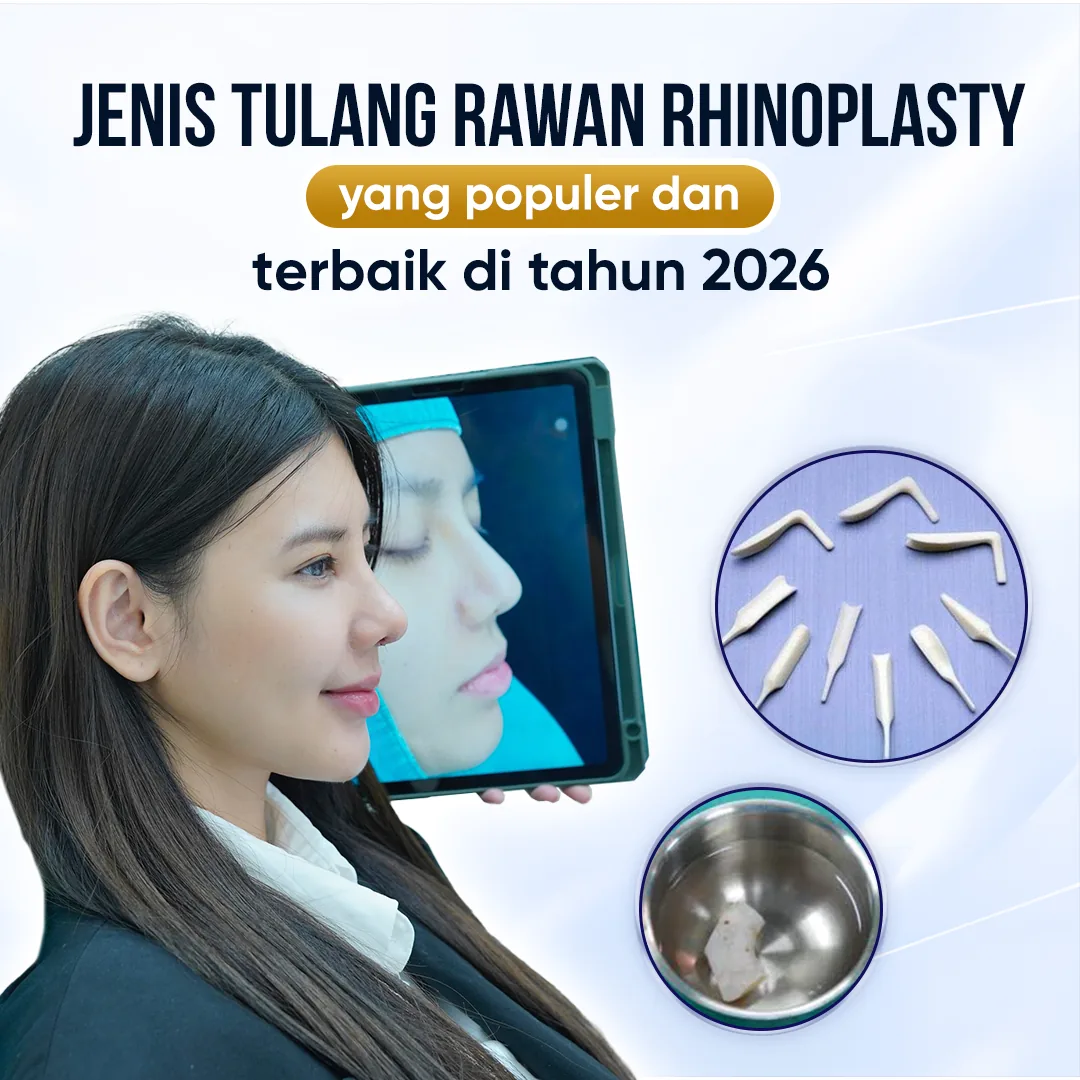 Ilustrasi Pembentukan Hidung Estetika – Panduan Rhinoplasty bagian 6