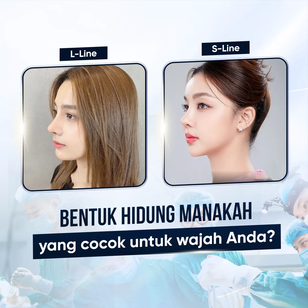 Ilustrasi Pembentukan Hidung Estetika – Panduan Rhinoplasty bagian 7