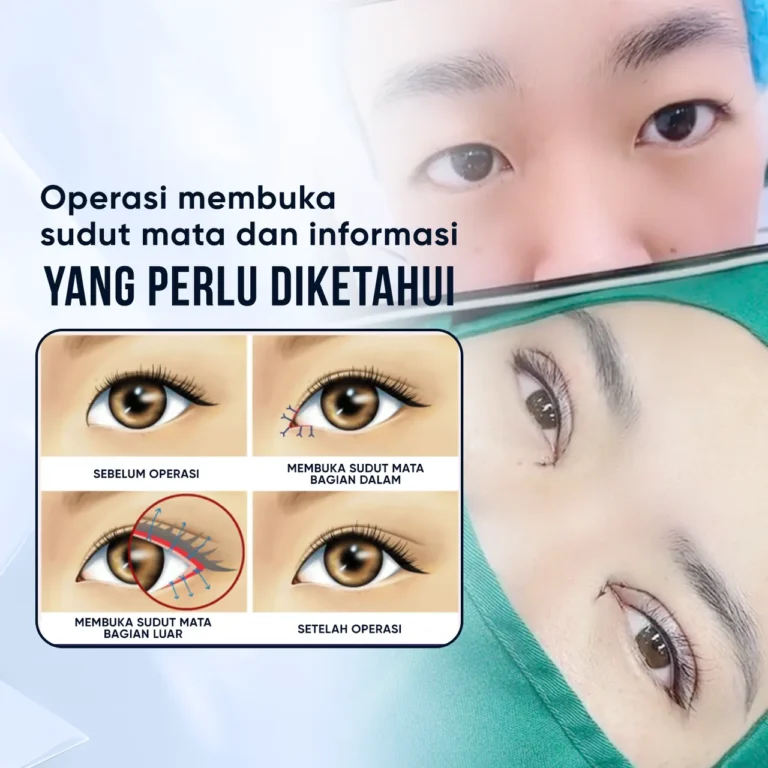 Ilustrasi Tata Bentuk Kelopak Mata Ganda – Transformasi Mata Indah & Alami dari The Lumie Beauty Center